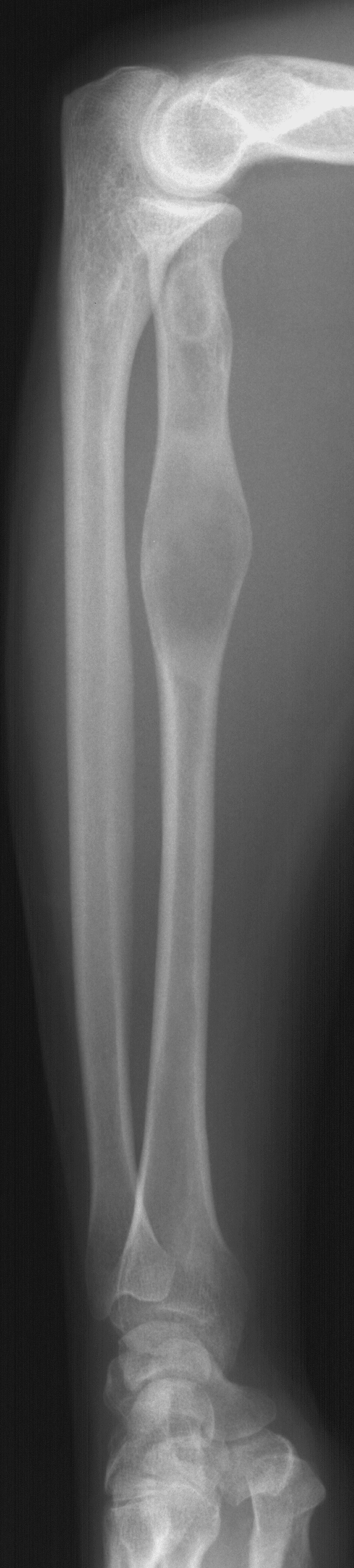 1. Lateral forearm